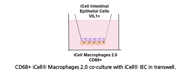 TREM2 Signal Pathway